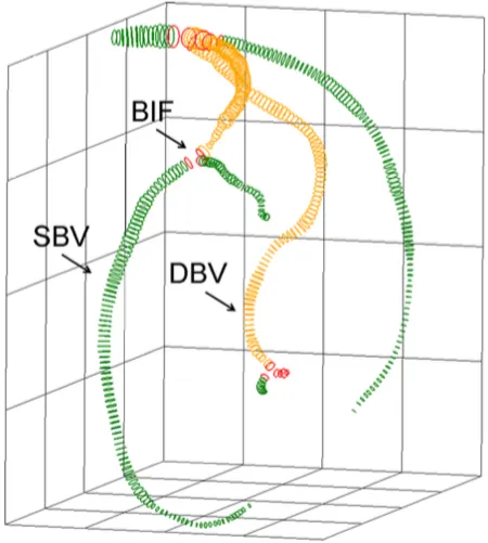 Segmentation process of the coronary artery.